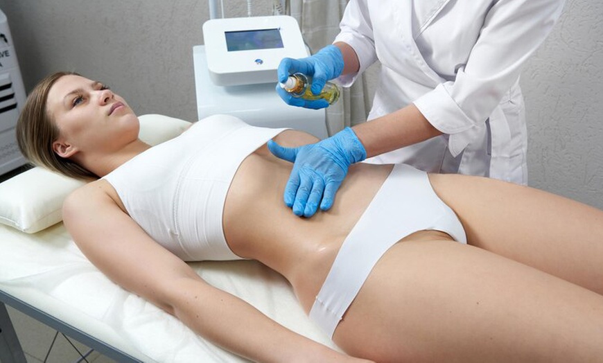 Image 3: Pour une silhouette redessinée : cryolipolyse avec Smart Body