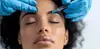 (Up To 45% Off) Youthful Glow with 20, 40, or 60 Units of Botox at RYCH Aesthetics