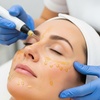 Image 1: Up to 60% Off on Vampire Facelift at U Beauty Med Clinic