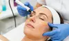 Up to 60% Off on Vampire Facelift at U Beauty Med Clinic