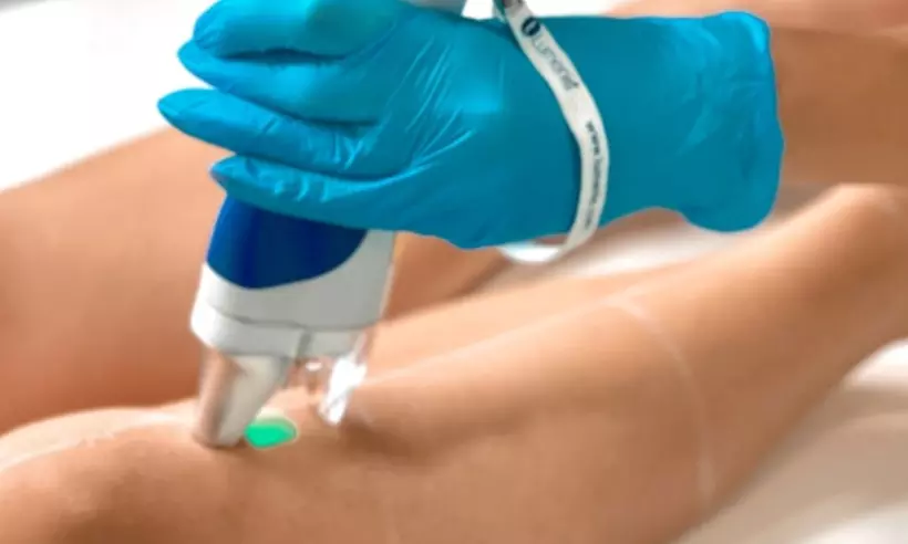 Six Laser Hair-Removal Sessions on a Medium, Large or Extra Large Area