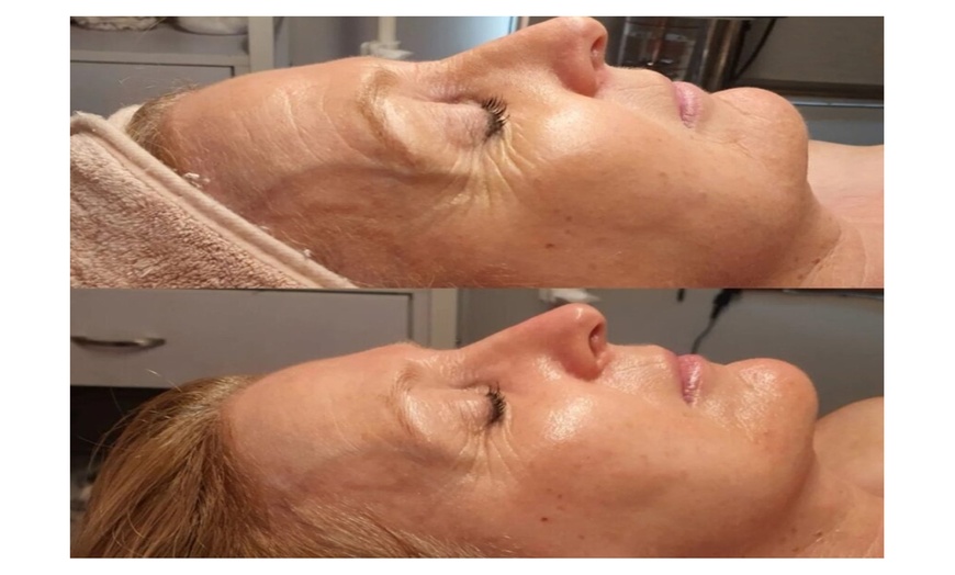 Image 3: Choose Medical Dermalux MD Triwave LED Light Therapy Pak of 10 or 20 