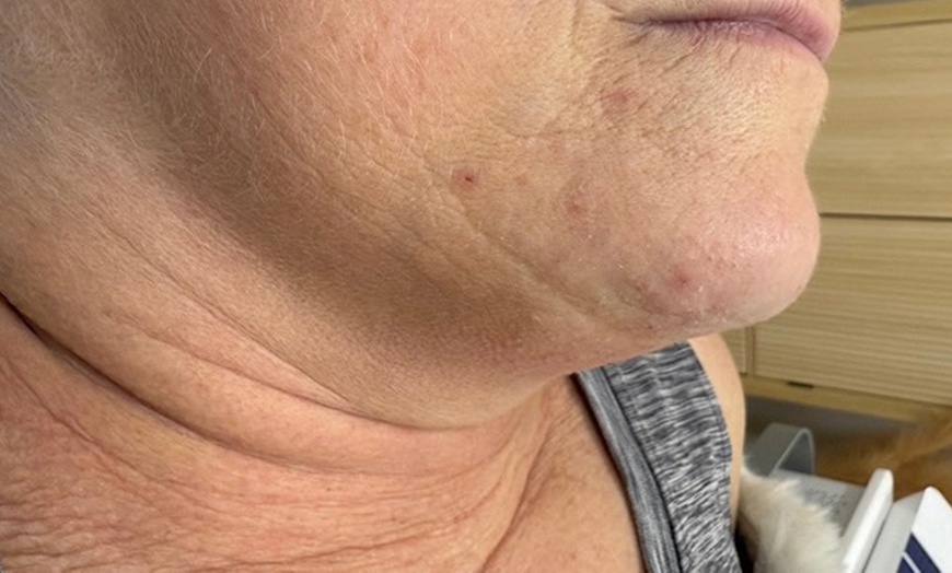 Image 3: Relax with Cryo & Thermal Body sculpting (2 or 3 sessions)