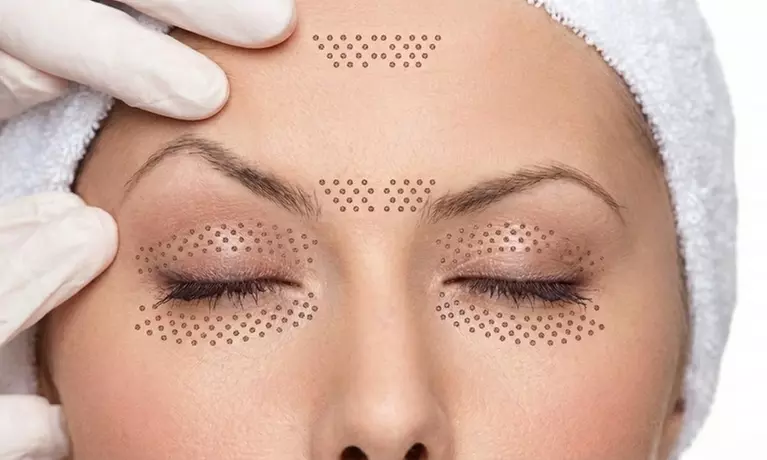 1 o 2 sesiones de plasma pen en zona a elegir para 1 persona