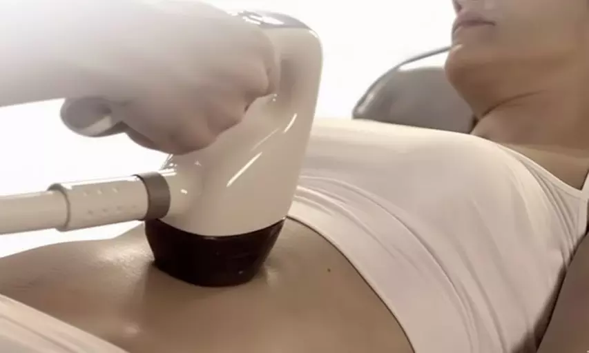 54% Off  3, 6, or 10 Velashape III Treatments at Renova Spa Temecula