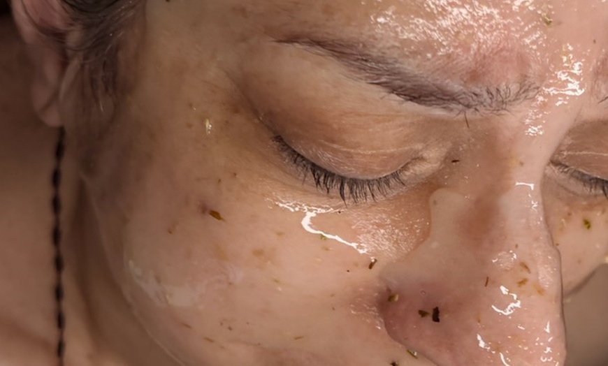 Image 6: Relax with One, Two, or Three 60-Minute HydraFacial Sessions