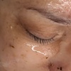 Image 6: Relax with One, Two, or Three 60-Minute HydraFacial Sessions
