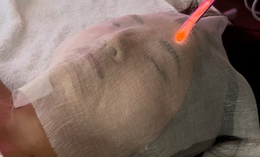 Image 2: 60 Min Microdermabrasion Facial w/ Mask+LED Therapy - 1, 3/ 5 Sessions