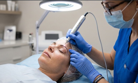 1 sesión de plasma pen Fibroblast en rostro completo