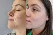 Glow Your Skin with One, Two or Three 60-Minute HydraFacial Session with Choice of Add-On @Susana (Up to 58%Off) - Image 2