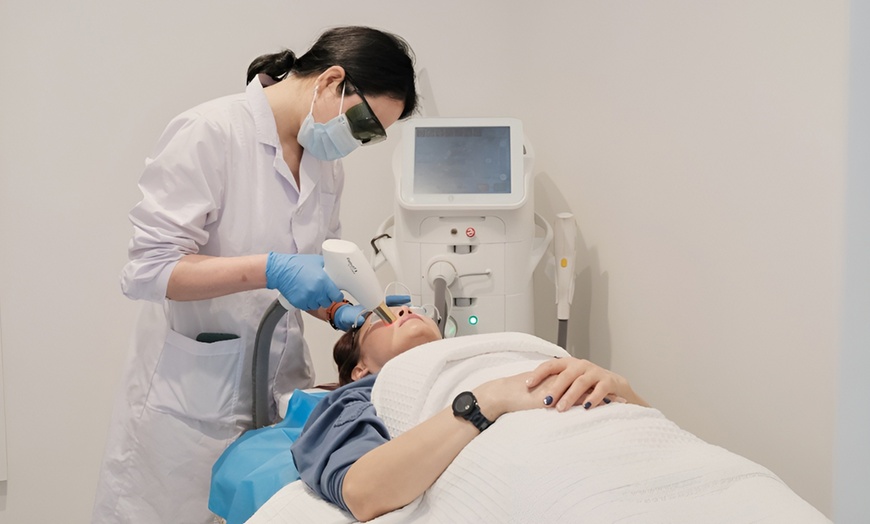 Image 2: Advanced IPL/Photofacial Stellar M22 for Clearer, Radiant Skin