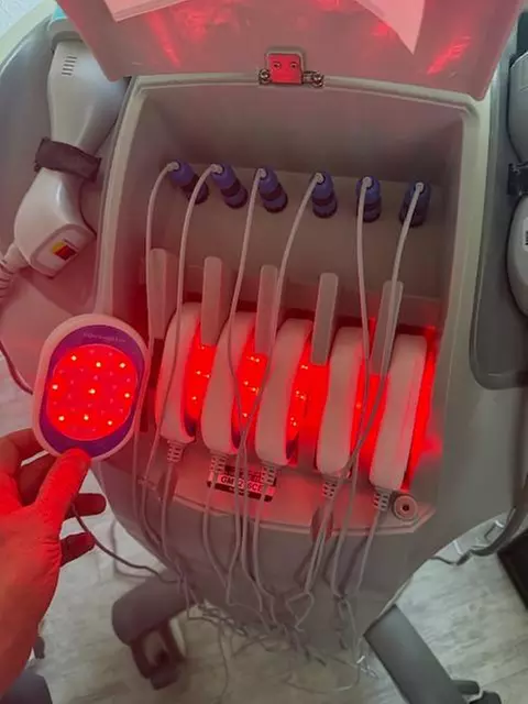 Achieve a Toned Look: Non-Invasive Laser Lipo Treatments