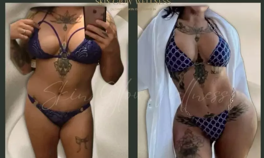 Up to 50% Off on EMS Body Sculpting at Skin Glow Wellness