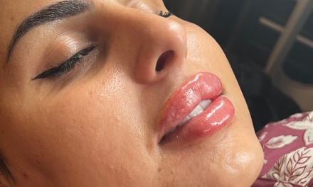1 ML For Lip or Chin or Cheek with consultation - 10.10 Aesthetics