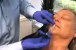 Smooth Out Wrinkles with 50 or 100 Units of Dysport at FaceLine Aesthetics (Up to 40% Off) - Second Medium