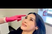20 or 40 Units of Botox Administered by Experienced Medical Professionals at Tacoma Laser Clinic (Up To 47% Off) - Second Medium