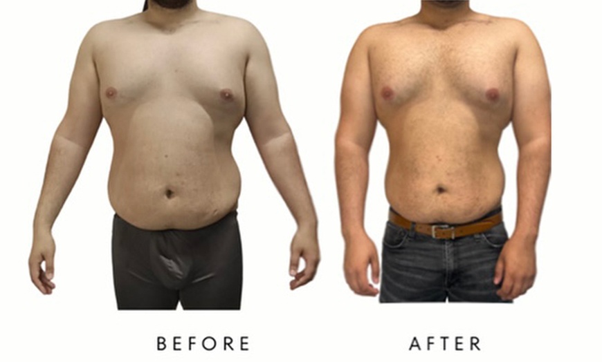 Image 4: PRECISION SLIM - Body Fat Loss & Skin Tightening at Your Sculpt Studio
