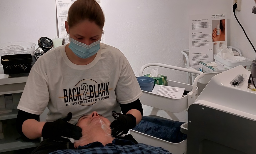 Image 4: Effectieve carbon laser peeling voor huidverjonging en collageenboost