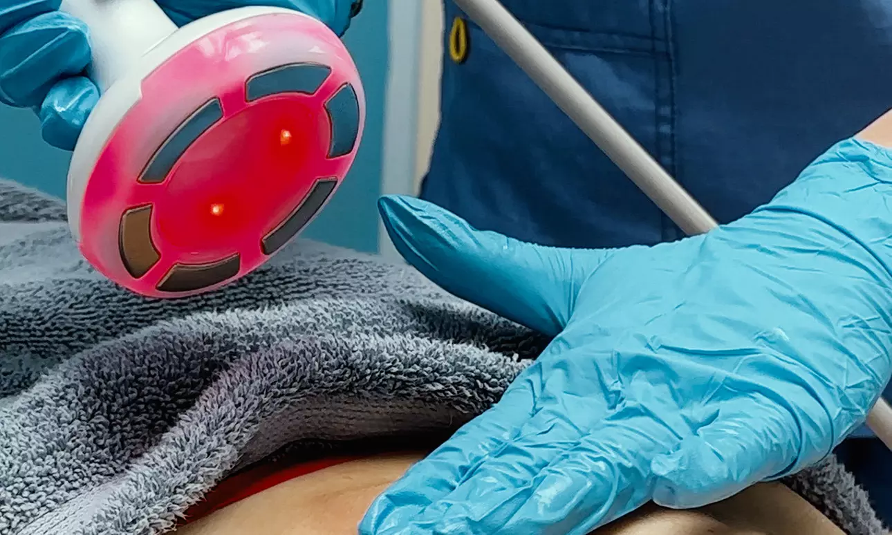 Body Cavitation & Radio Frequency or LPG Endermologie Cavitation