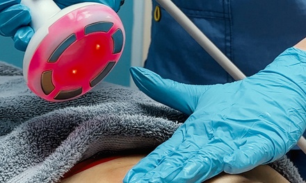 One 60-Minute Body Cavitation and Radio Frequency for One Body Part - New U Body Aesthetics Schaumburg