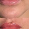 Image 5: Get Flawless Lips with One Lip Blush Session with Optional Touch-Up