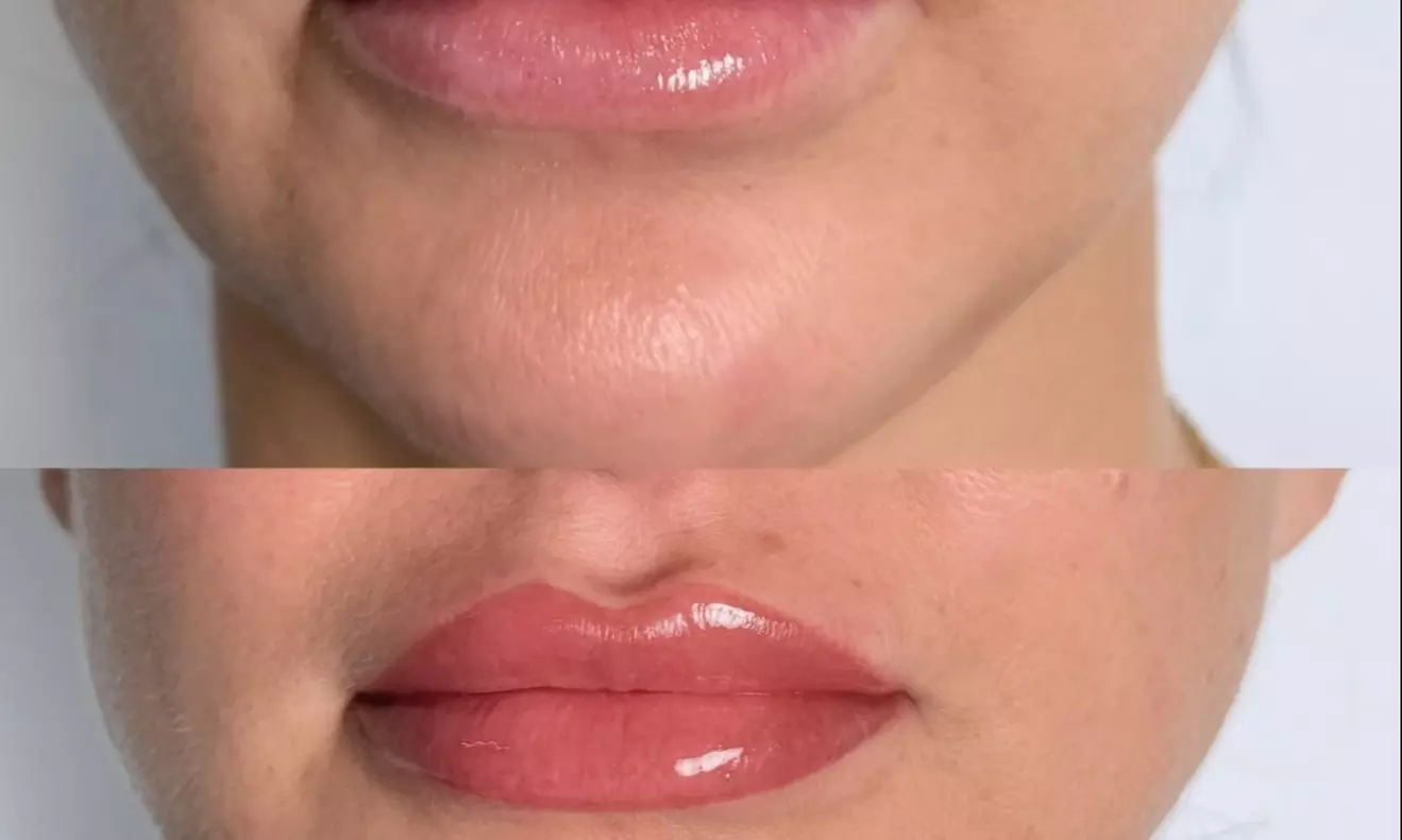 Get Flawless Lips with One Lip Blush Session with Optional Touch-Up