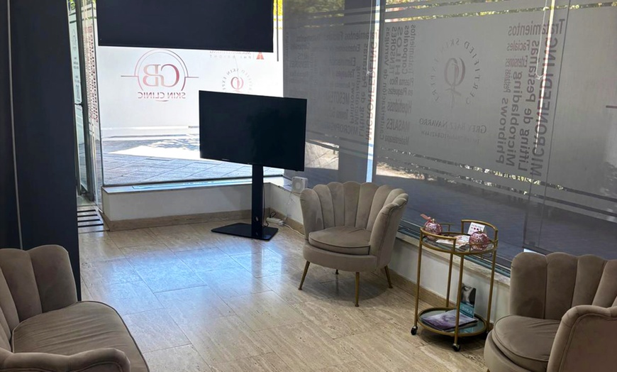 Image 4: Hasta 3 sesiones de maderoterapia facial o corporal y radiofrecuencia