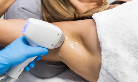 : 1 sesión de depilación láser / Zona pequeña o mediana - Juliette depilación laser