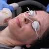 Image 4: One IPL Photofacial Treatment at Total Med Solutions