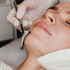 Image 2: Revitalise Your Complexion with Luxury Laser & Skin Facials