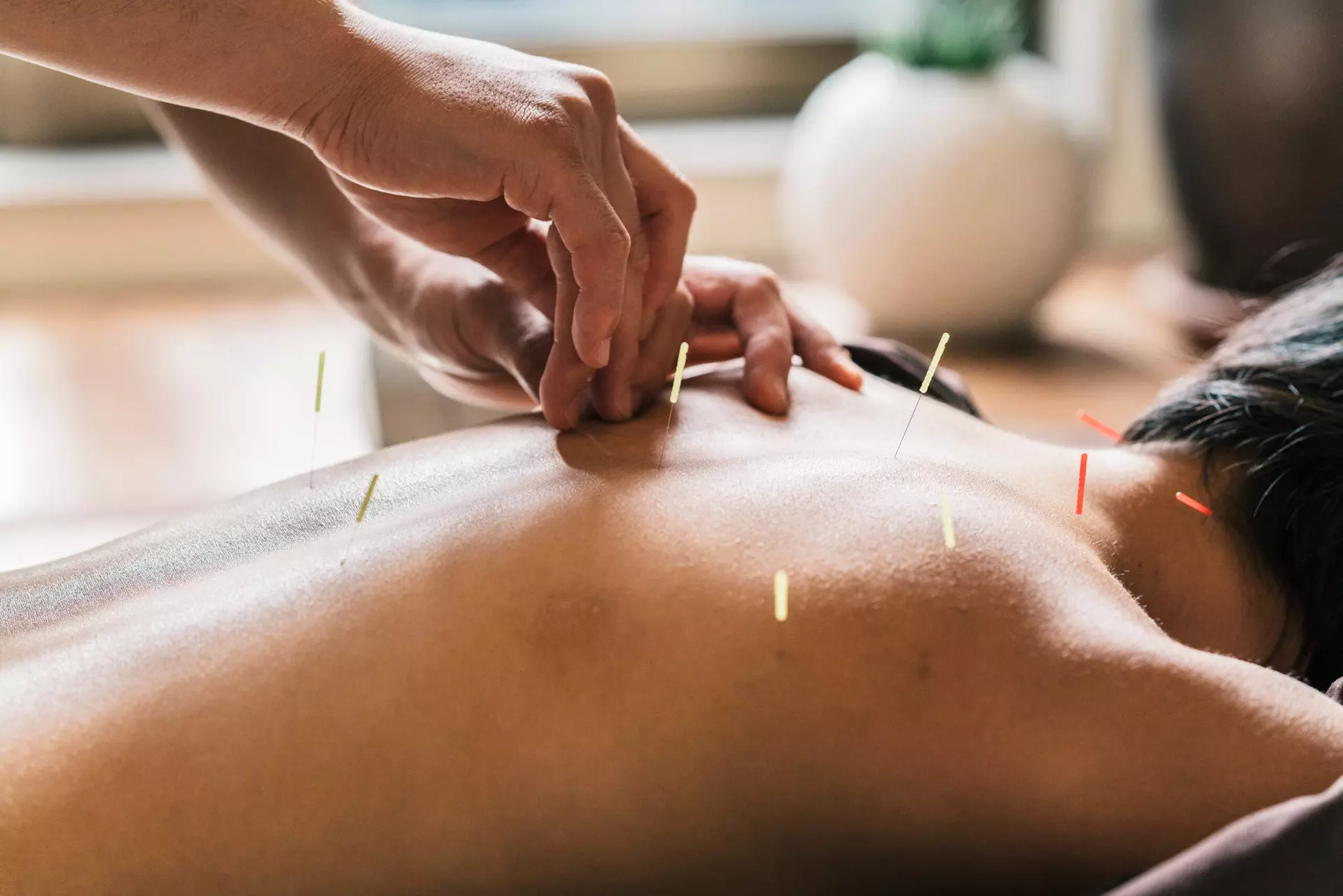 Up to 53% Off on Acupuncture at True Peace Acupuncture