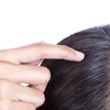 Image 1: Hair Restore Treatment PRP + Microneedling, Exosomes & Celluma Light