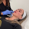 Image 6: Beauty in Balance - Botox at Rio MedSpa