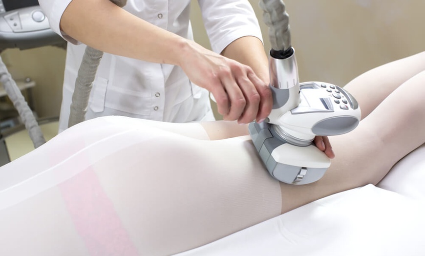 Image 3: ENDERMOLOGIE LPG w/ Optional Glow Facial 
