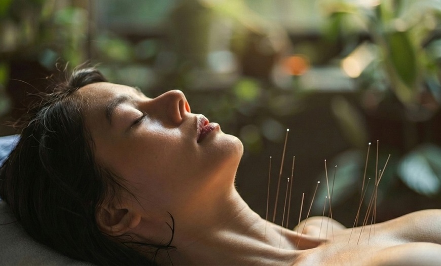 Image 2: Acupuncture with Optional Cupping for Pain Relief & Whole-Body Balance