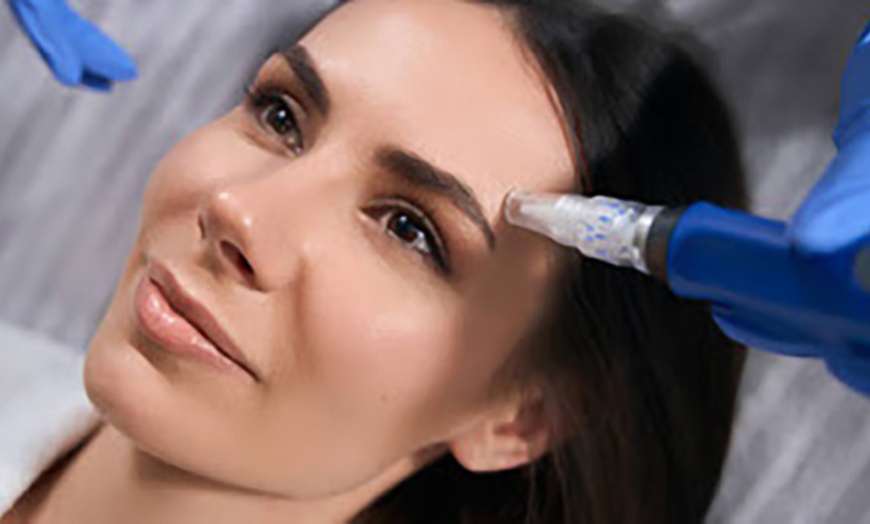 Image 3: Get a Immune Boost, Meyer's Cocktail or Inner Beauty IV Hydration