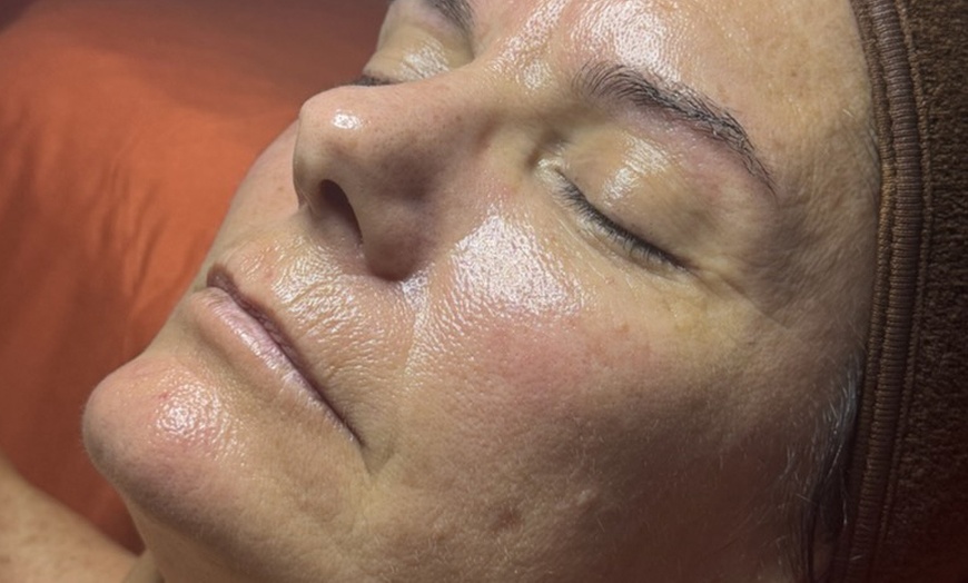Image 2: Relax with One, Two, or Three 60-Minute HydraFacial Sessions