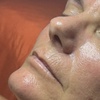 Image 2: Relax with One, Two, or Three 60-Minute HydraFacial Sessions