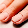 Image 2: Medical Pedicure, Callus Reduction or Nail Fungus Consultation

