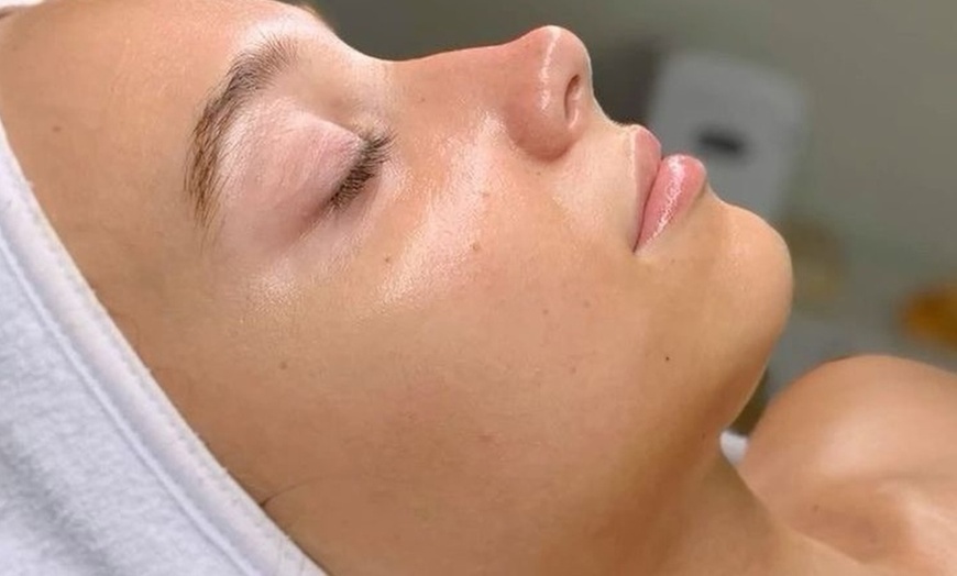 Image 10: Up to 63% Off on Chemical Peel at Allure Passions Aesthetic Clinic