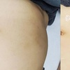 Image 3: Up to 73% Off on Spa / Salon Beauty Treatments at Beauty Line