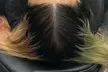 2 or 4 Hour Scalp Micropigmentation for Hairline, Crown or Full Scalp Restoration at Authentic SMP(Up to 33%Off) - Second Medium