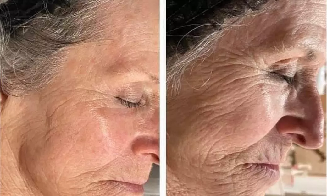 Permanent Makeup & Advanced Microchanneling