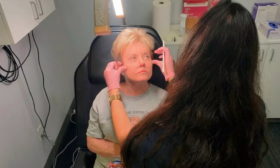 Lip Filler and Enhancement Options Using Evolysse