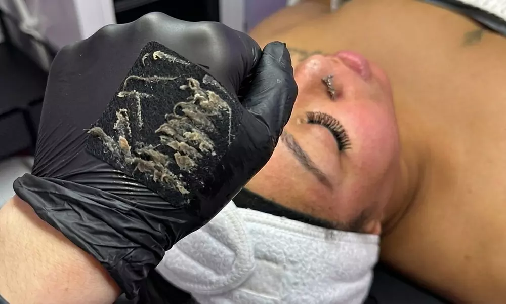 HydroFacial Treatments with Essential Glow Glass Skin & Reset Options