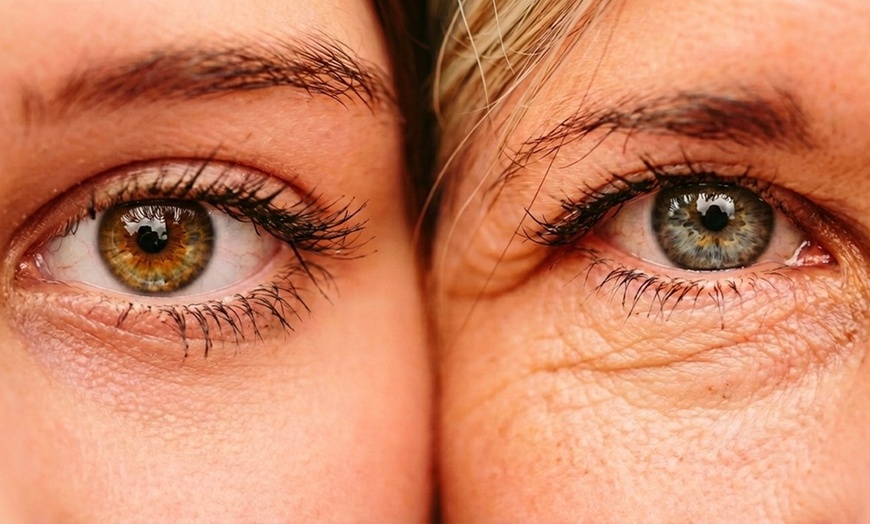 Image 2: Refresh Your Look with Profhilo® Sessions at Aesthetic Zone