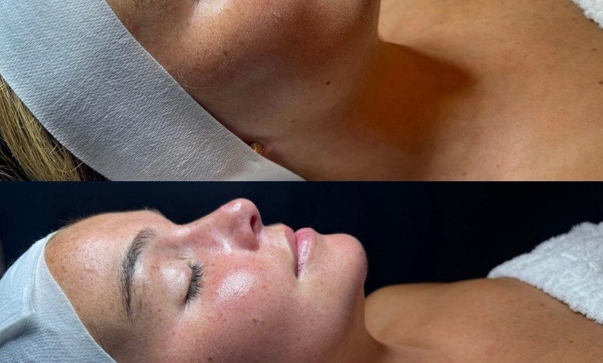 Image 2: Facial with Massage & LED Light Therapy Options