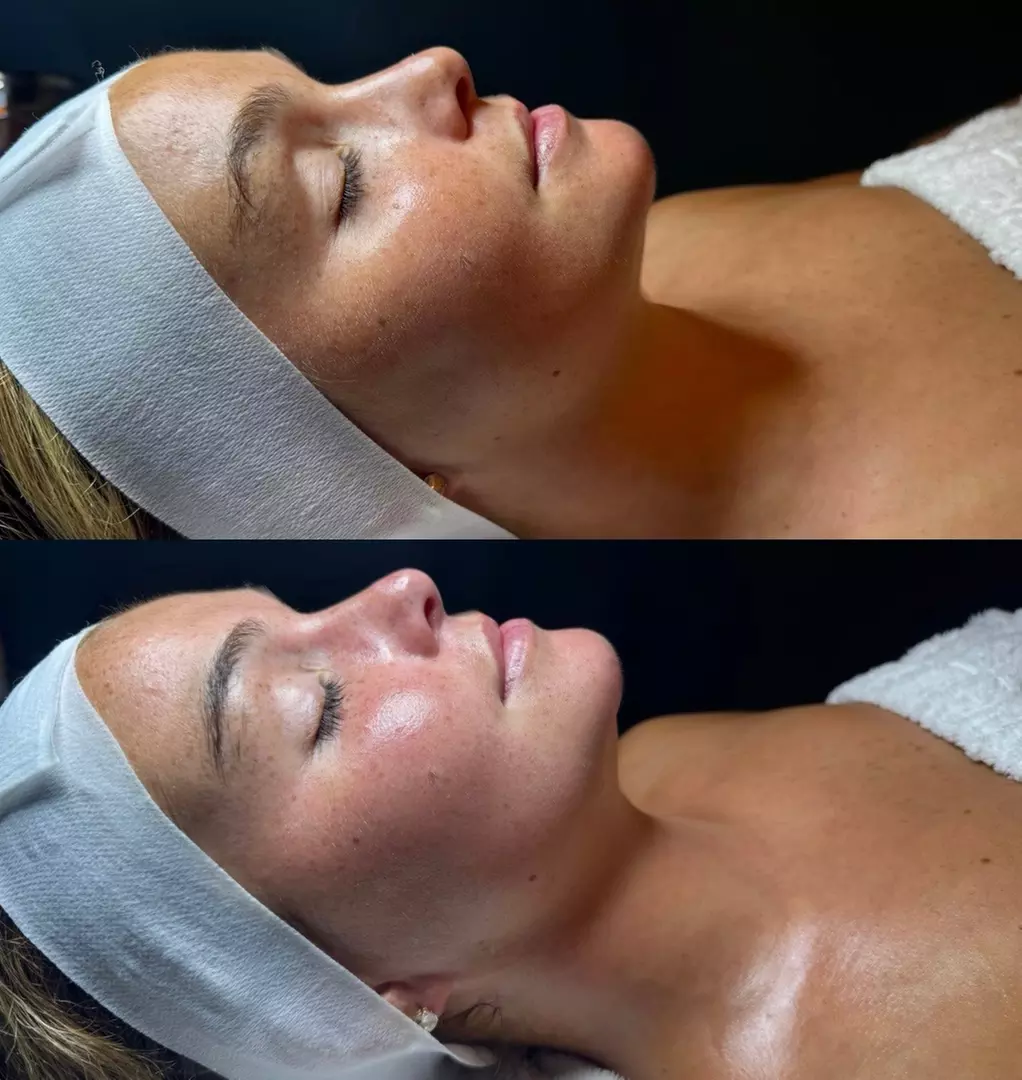 Facial with Massage & LED Light Therapy Options