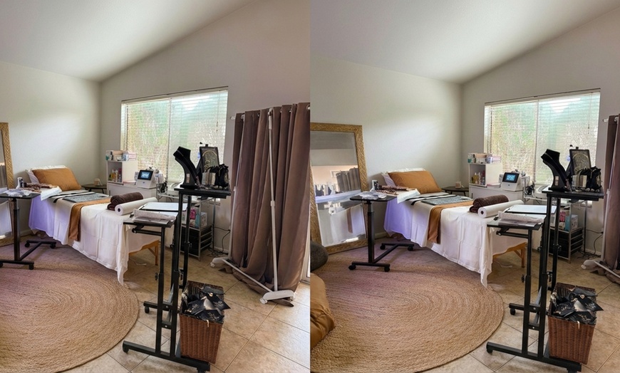 Image 3: 1 or 3 20 Min RF for Hands & Feet or 35-Min RF w/ Cavitation Sessions