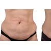 Image 2: Cryo Liposculpt Intro Sessions for Chin, Back, Arms or Thighs